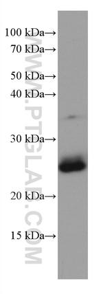 RAB3D Antibody in Western Blot (WB)