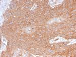 Spectrin beta III (SPTBN2) Recombinant Rabbit Monoclonal Antibody (SPTBN2/2894R)