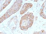Spectrin beta III (SPTBN2) Recombinant Rabbit Monoclonal Antibody (SPTBN2/2979R)