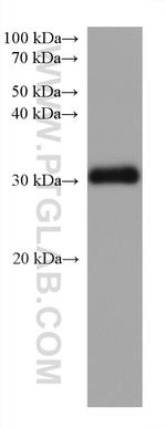 STAR Antibody in Western Blot (WB)