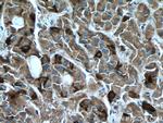 FSH beta Antibody in Immunohistochemistry (Paraffin) (IHC (P))