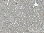 STXBP1 Antibody in Immunohistochemistry (Paraffin) (IHC (P))