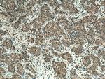 URG4 Antibody in Immunohistochemistry (Paraffin) (IHC (P))