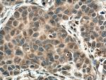 URG4 Antibody in Immunohistochemistry (Paraffin) (IHC (P))