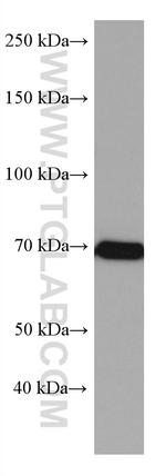 CDC25B Antibody in Western Blot (WB)