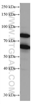 RANGAP1 Antibody in Western Blot (WB)