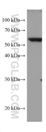 TROVE2 Antibody in Western Blot (WB)