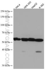 TMPO/LAP2 Antibody in Western Blot (WB)