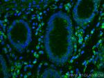 HIP1 Antibody in Immunohistochemistry (Paraffin) (IHC (P))
