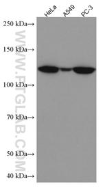 HIP1 Antibody in Western Blot (WB)