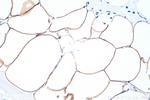 ACLY Antibody in Immunohistochemistry (Paraffin) (IHC (P))