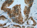 ACLY Antibody in Immunohistochemistry (Paraffin) (IHC (P))