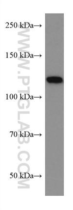 ACLY Antibody in Western Blot (WB)