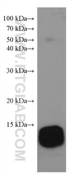 FABP4 Antibody in Western Blot (WB)