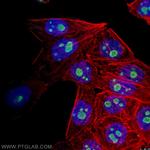 GNL3 Antibody in Immunocytochemistry (ICC/IF)