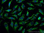 CUL2 Antibody in Immunocytochemistry (ICC/IF)