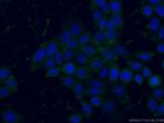 GPI Antibody in Immunocytochemistry (ICC/IF)