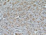 KIF20A Antibody in Immunohistochemistry (Paraffin) (IHC (P))