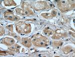 KIF20A Antibody in Immunohistochemistry (Paraffin) (IHC (P))