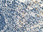 UNC13D Antibody in Immunohistochemistry (Paraffin) (IHC (P))