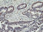 UBE1 Antibody in Immunohistochemistry (Paraffin) (IHC (P))