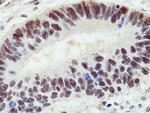 UBE1 Antibody in Immunohistochemistry (Paraffin) (IHC (P))