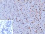 BRCA1 (Breast Marker) Recombinant Rabbit Monoclonal Antibody (BRCA1/9797R)