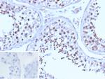 BRCA1 (Breast Marker) Recombinant Rabbit Monoclonal Antibody (BRCA1/13502R)
