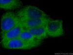 SBDS Antibody in Immunocytochemistry (ICC/IF)