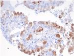 SREBP2 (Transcription Factor) Monoclonal Antibody (SREBP2/1580)