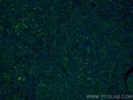BCAR1 Antibody in Immunohistochemistry (Paraffin) (IHC (P))