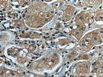 BCAR1 Antibody in Immunohistochemistry (Paraffin) (IHC (P))