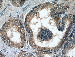MRP4 Antibody in Immunohistochemistry (Paraffin) (IHC (P))