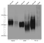 MRP4 Antibody in Western Blot (WB)