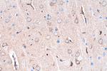S100A1 Antibody in Immunohistochemistry (Paraffin) (IHC (P))