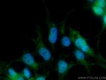 CDC27/APC3 Antibody in Immunocytochemistry (ICC/IF)