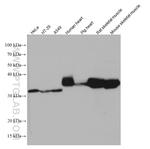TPM4 Antibody in Western Blot (WB)