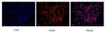 CDK9 Antibody in Immunocytochemistry (ICC/IF)