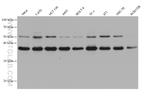 CDK9 Antibody in Western Blot (WB)