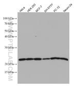 KRAS-2A Antibody in Western Blot (WB)