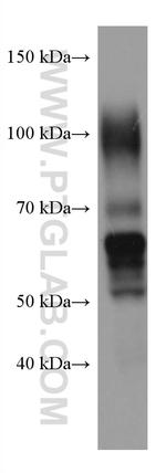 PSG1 Antibody in Western Blot (WB)