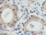 WWP2 Antibody in Immunohistochemistry (Paraffin) (IHC (P))