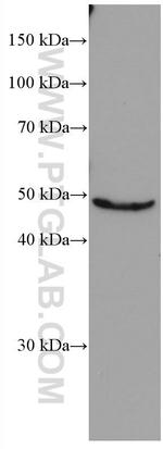 Biglycan Antibody in Western Blot (WB)