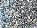 CD5 Antibody in Immunohistochemistry (Paraffin) (IHC (P))