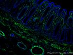 Collagen Type I Antibody in Immunohistochemistry (Paraffin) (IHC (P))