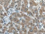 ERN2 Antibody in Immunohistochemistry (Paraffin) (IHC (P))