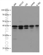 KLF6 Antibody in Western Blot (WB)