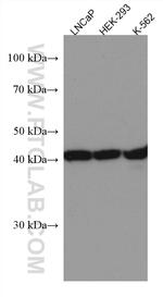 LIAS Antibody in Western Blot (WB)