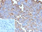 BRAF (V600E Mutant Specific) (Prognostic Marker) Recombinant Rabbit Monoclonal Antibody (BRAF-V600E/13276R)