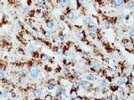 CD107a Antibody in Immunohistochemistry (Paraffin) (IHC (P))